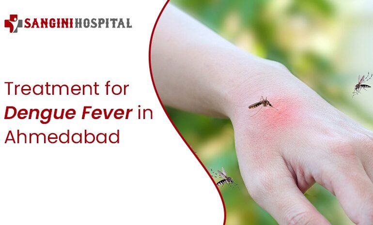 Treatment for Dengue Fever in Ahmedabad