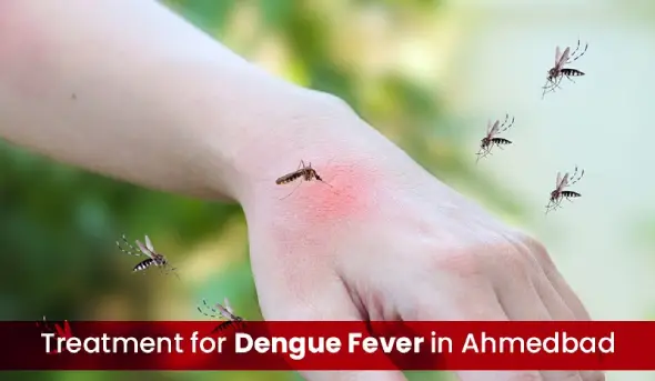 Treatment for Dengue Fever in Ahmedabad