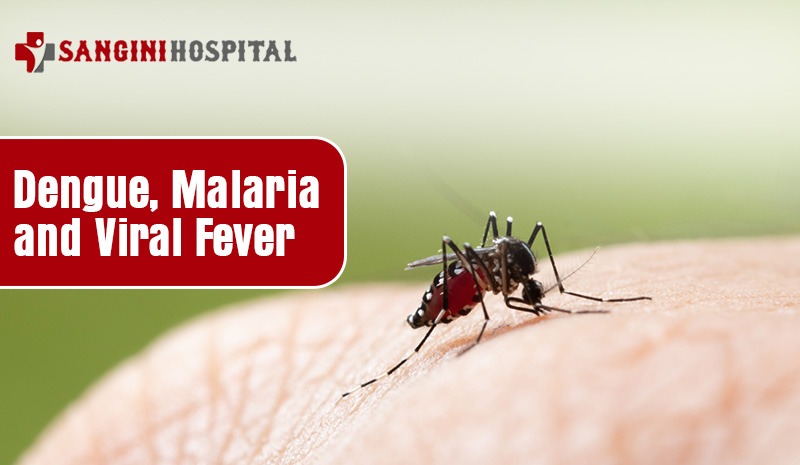 Dengue, Malaria and Viral Fever