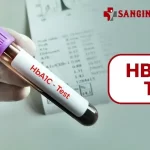 HbA1c Test