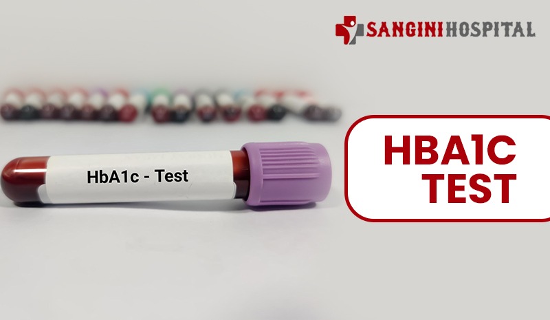 HbA1c Test