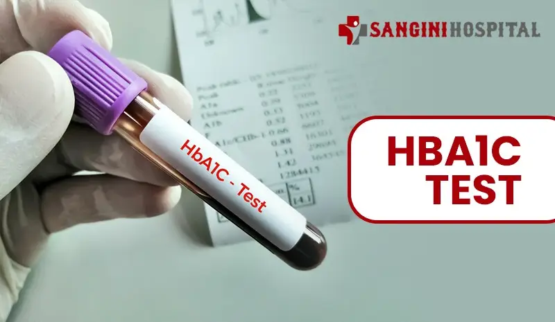 HbA1c Test