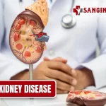 Diabetic Kidney Disease