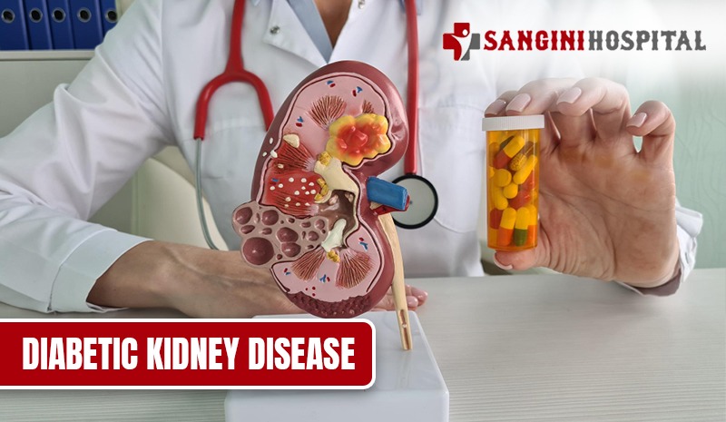 Diabetic Kidney Disease