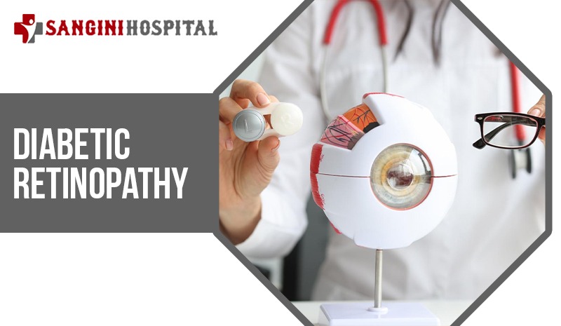Diabetic Retinopathy
